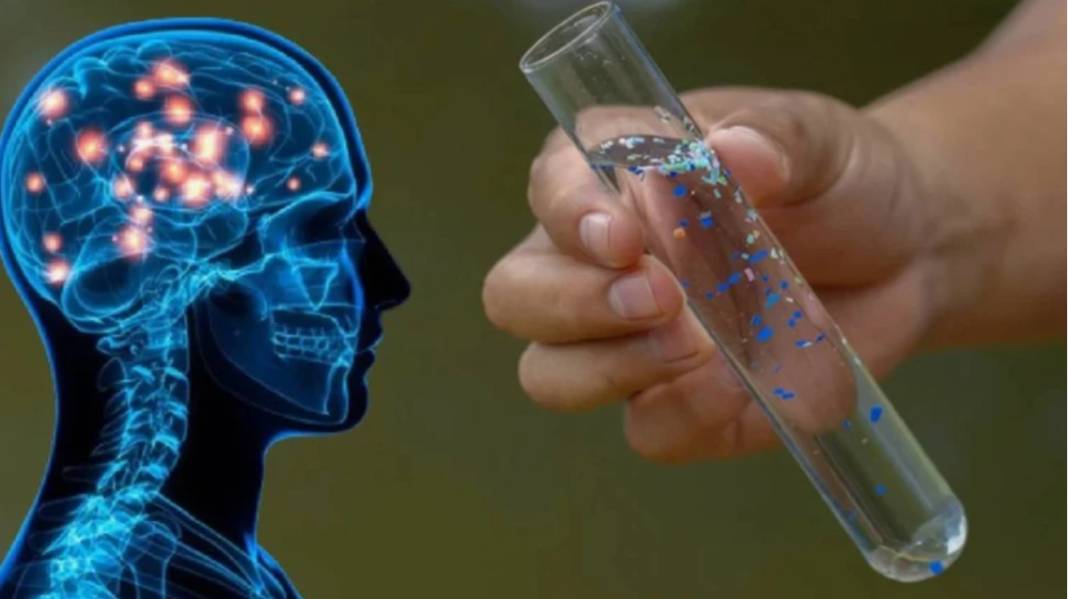 Yeni araştırma şoke etti! Depresyonda olmanızın sebebi beyninizdeki mikroplastikler olabilir 2