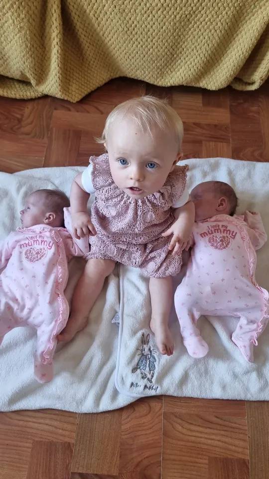 TIP DÜNYASINI ŞOKA SOKAN DOĞUM: 9 Ayda 3 bebek doğurdu, ama üçüz değiller! 3