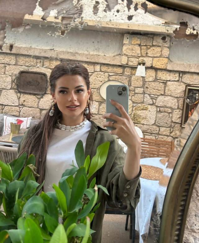 Bez Bebek’in sevimli kızı büyüdü! Elif Ceren Balıkçı’nın son hali görenleri şaşırttı 25
