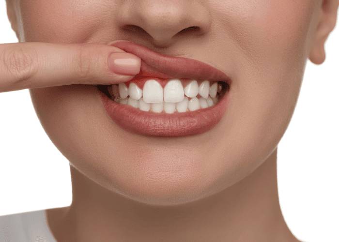 Sadece diş fırçalamak yetmeyebilir! Yeni araştırma şaşırttı: Popüler bir diyet şekli diş etini koruyor 1