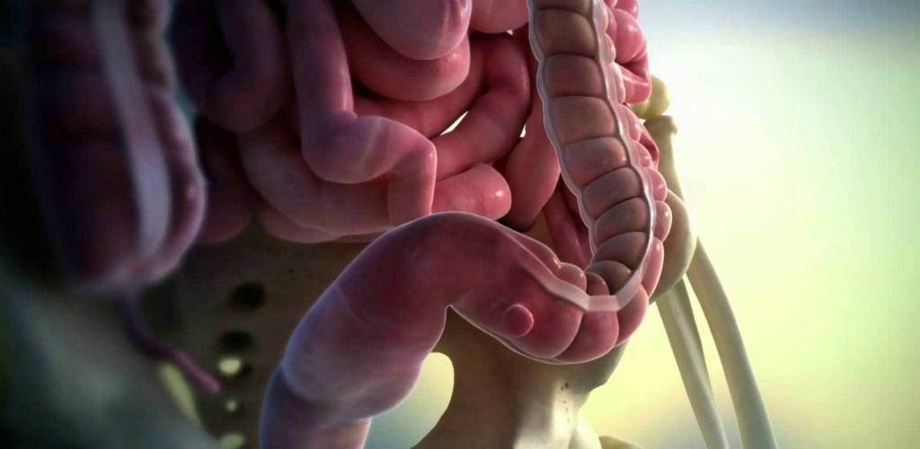 Her 3 kişiden 2’si lif eksikliği yaşıyor: Bağırsaklarda divertiküler hastalık gençlerde de artıyor! 3