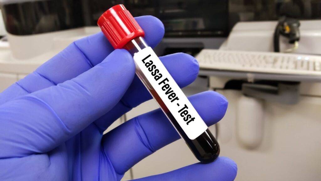 ÖLÜMCÜL HASTALIK GİTGİDE YAYILIYOR: Bu hayvanlardan uzak durun! 4