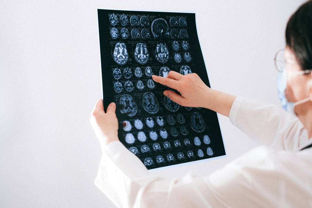 Beyni genç tutan alışkanlık ortaya çıktı! Alzheimer ve demans riskini yüzde 22 azaltıyor 4