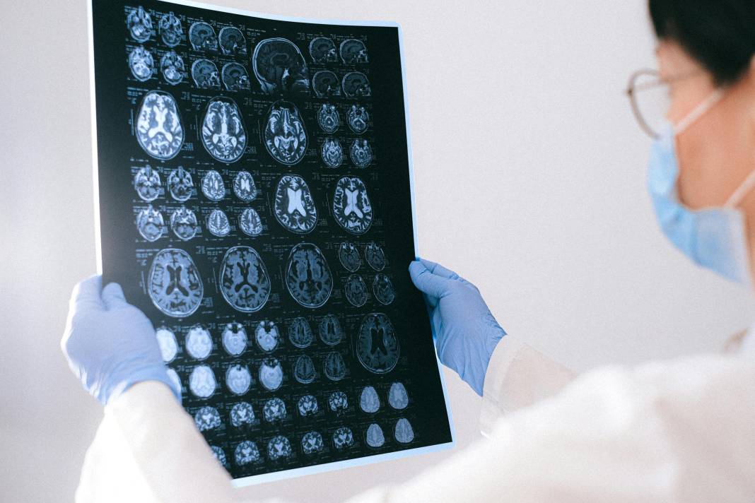 Beyni genç tutan alışkanlık ortaya çıktı! Alzheimer ve demans riskini yüzde 22 azaltıyor 1