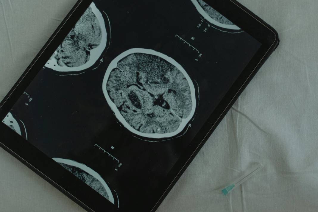 Beyni genç tutan alışkanlık ortaya çıktı! Alzheimer ve demans riskini yüzde 22 azaltıyor 9