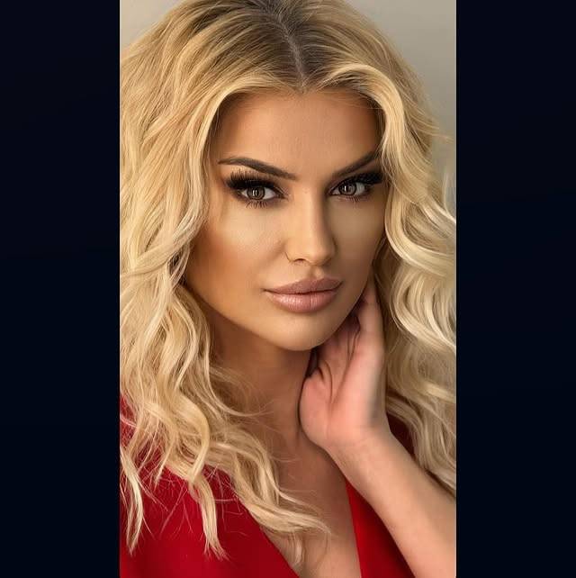 Son hali gündeme bomba gibi düştü! Songül Karlı estetik iddialarına ilk kez yanıt verdi 4