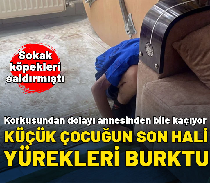 Köpeklerin ağır yaraladığı Tunahan eve kapandı herkesten kaçıyor