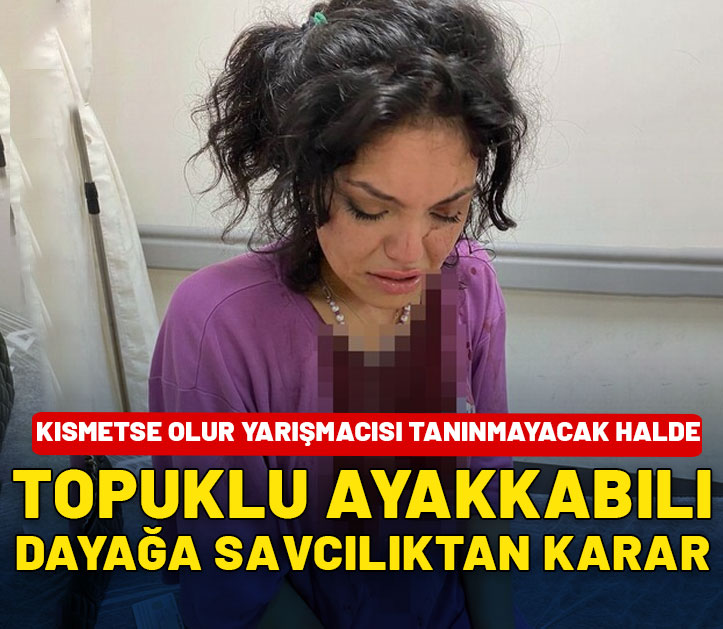 Kısmetse Olur yarışmacısı Eslem'e topuklu ayakkabılı dayak: Savcılık'tan yeni karar