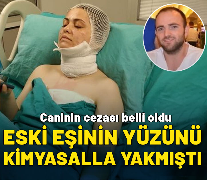 Eski eşinin yüzünü kimyasalla yakan caninin cezası belli oldu