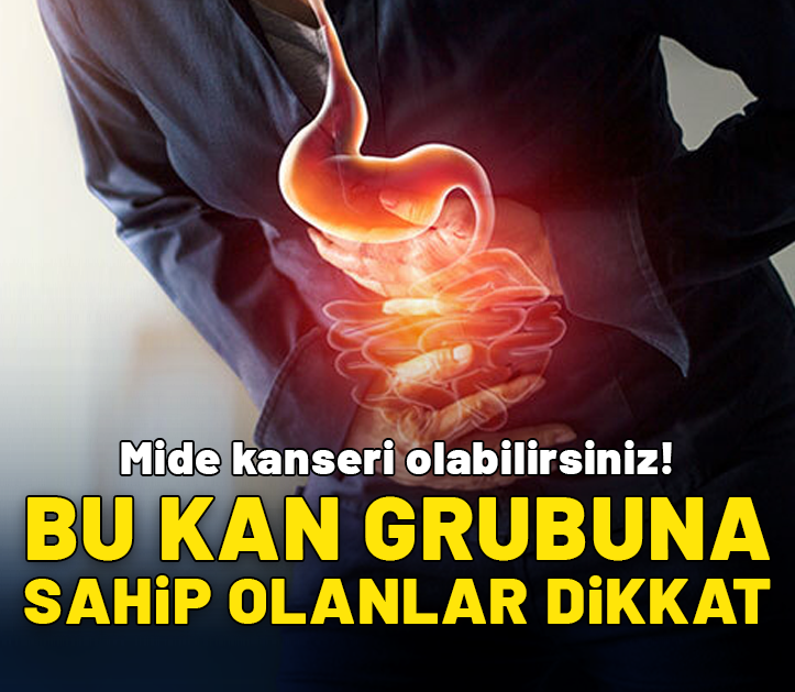 Bu kan grubuna sahip olanlar dikkat! Mide kanseri olabilirsiniz