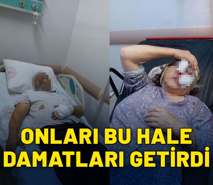 Damat dehşeti! Kayınpederiyle kayınvalidesini hastanelik etti