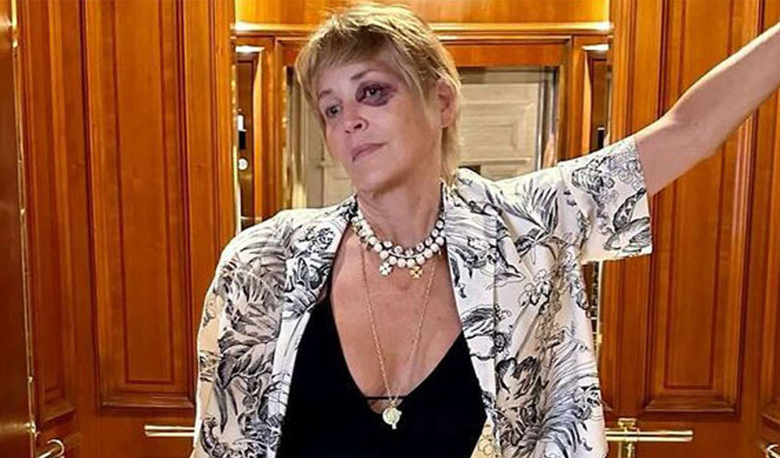 Sharon Stone, tuvalette kaza geçirdi