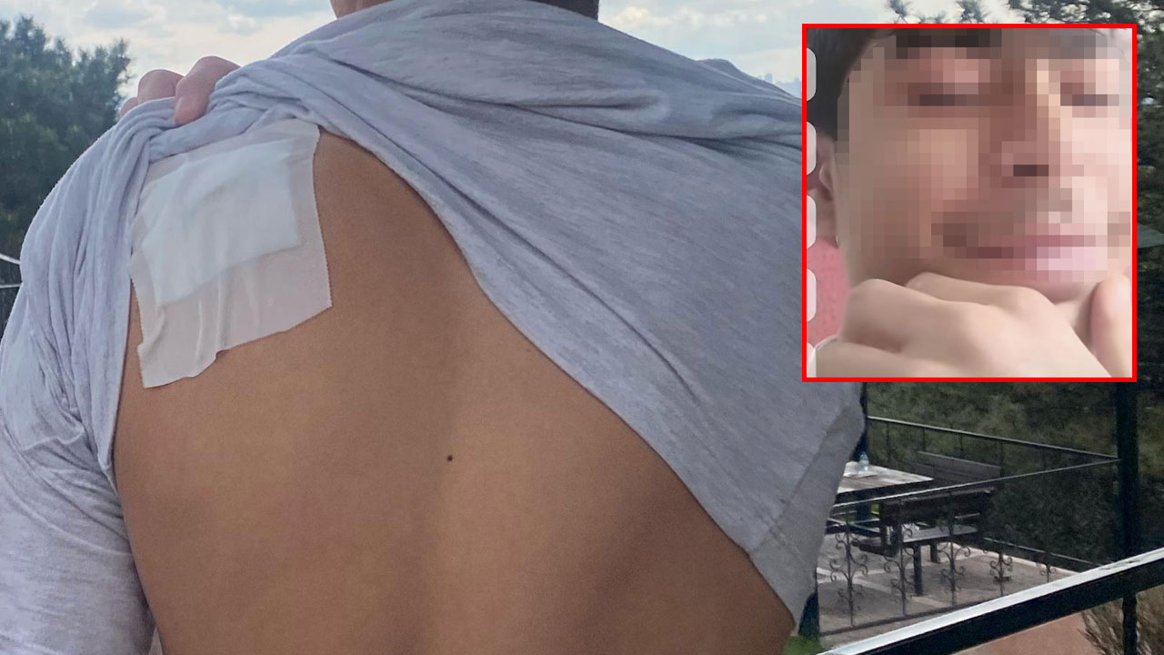 13 yaşındaki çocuk parkta bıçaklandı, saldırgan serbest bırakıldı: Ailesi isyan etti