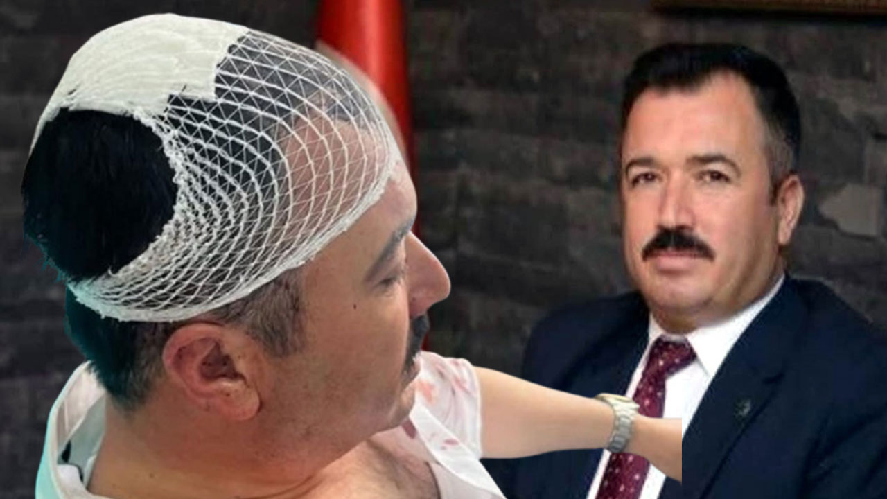 Belediye başkan yardımcısına şekerlikle saldıran ilk başkanı tutuklandı