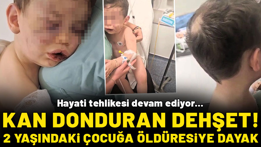 Kan donduran dehşet: 2 yaşındaki bebek annesinin sevgilisi tarafından öldüresiye dövüldü