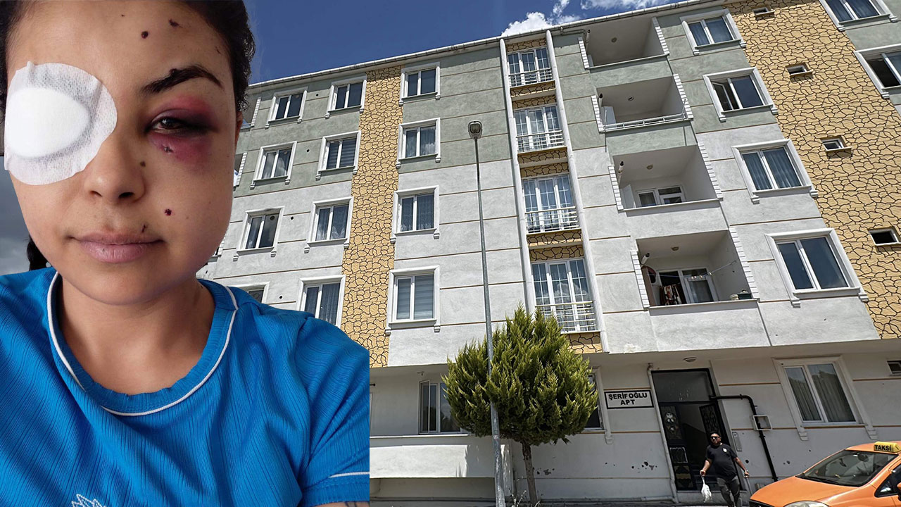 Pencereden düğünü izliyordu, sonrası dehşet! 22 yaşındaki genç anne kör olma tehlikesi ile karşı karşıya!