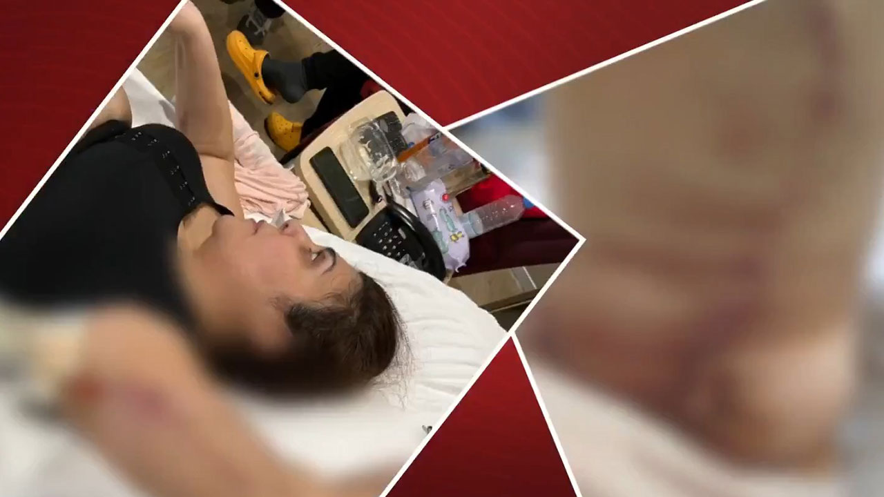 Yürüyerek estetik ameliyata gitti; felç  çıktı! Ünlü oyuncu güzelleşmek için gitmişti, kısmi felç geçirdi