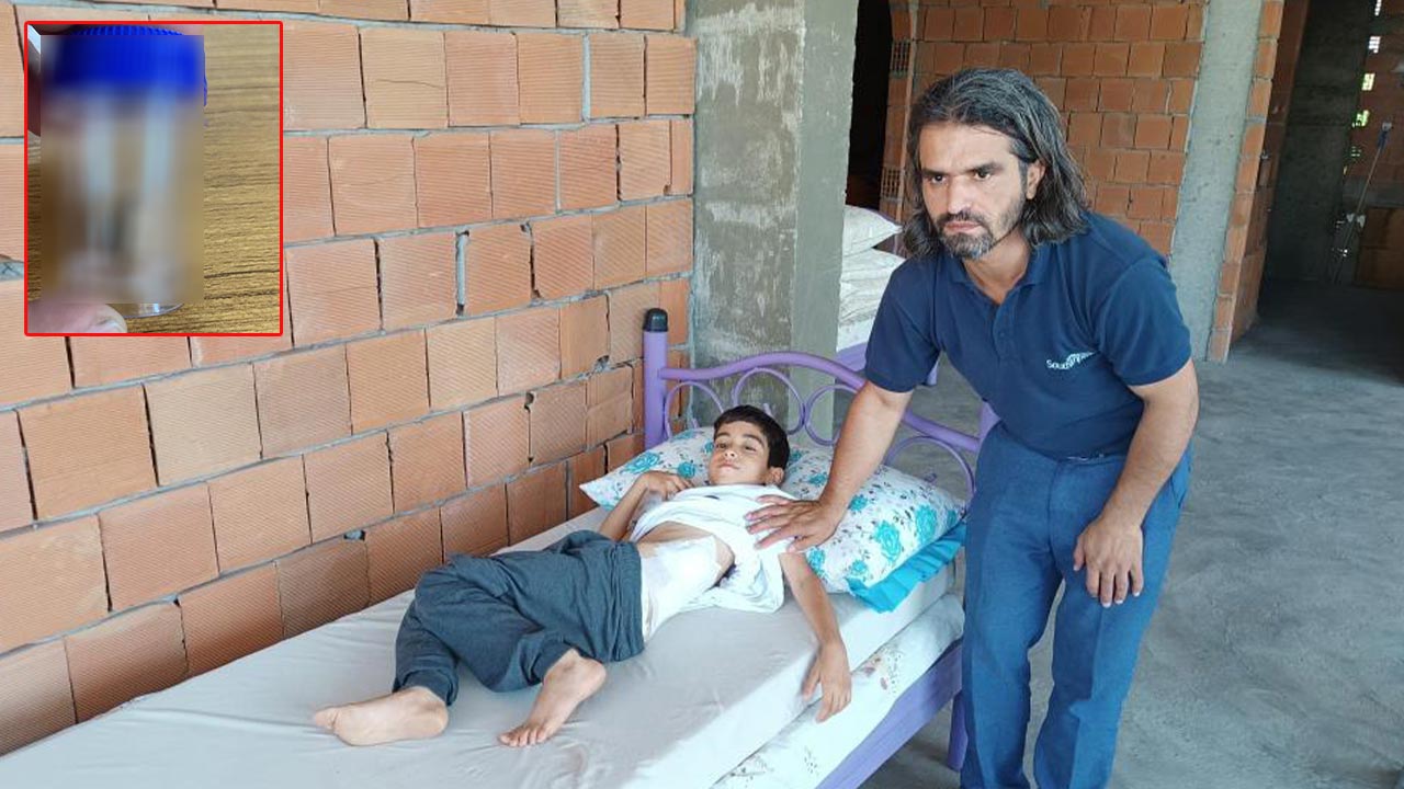 Sırtına birden bire ağrı girdi: Küçük çocuğun sırtından bakın ne çıktı
