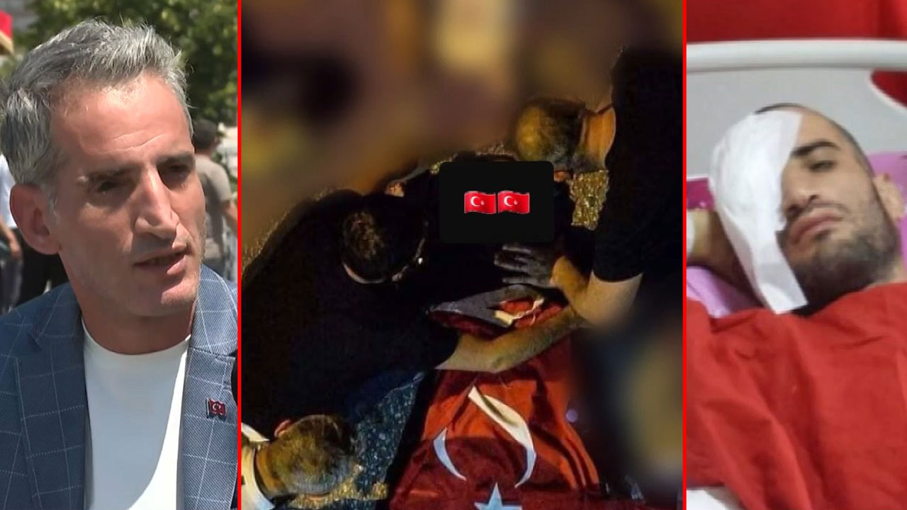 Gözünden vurulan 15 Temmuz gazisi İsmail Acur: Bir daha olsa yine sokağa çıkarım!