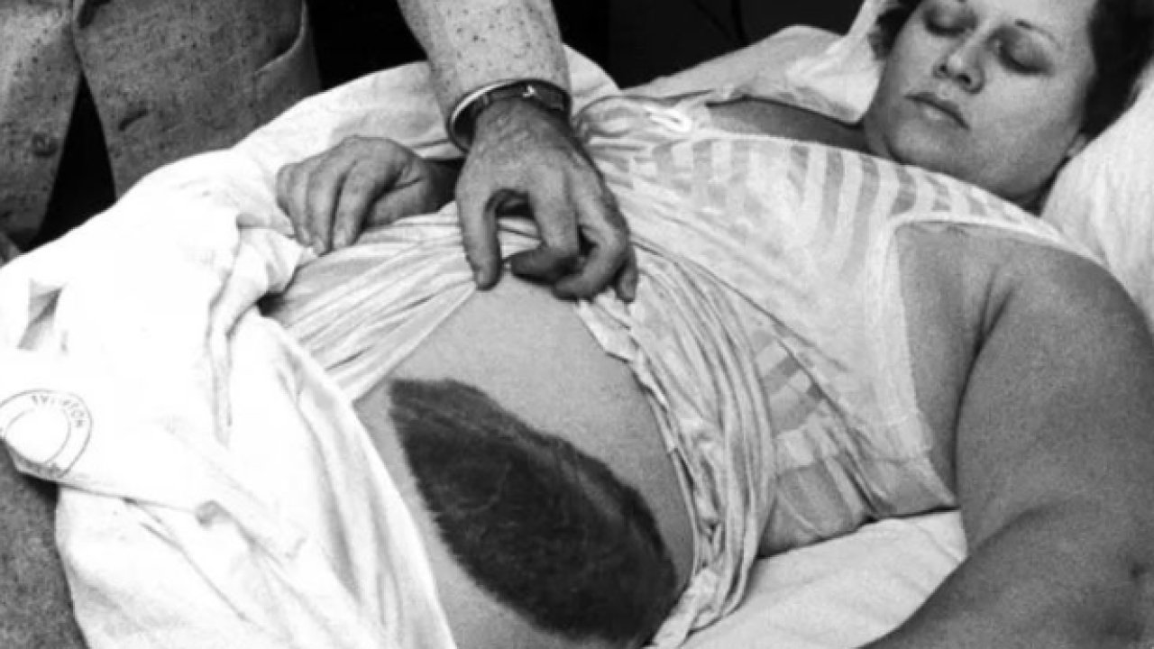 Meteor çarpmasıyla tarihe geçti: 4,5 milyar yıllık kayalık ve Ann Hodges’ın şans hikayesi