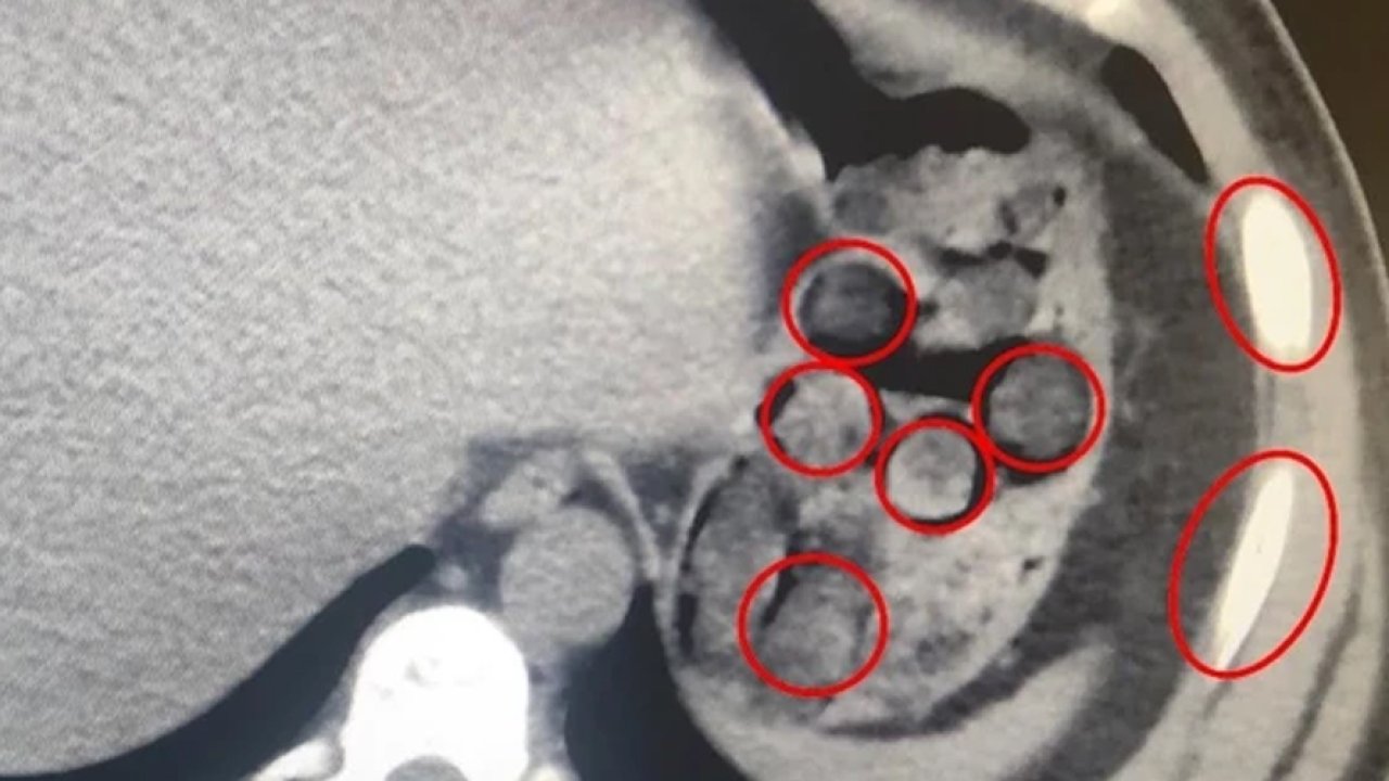 Midesinden çıkanlar şaşırttı: Ekipler harekete geçti!