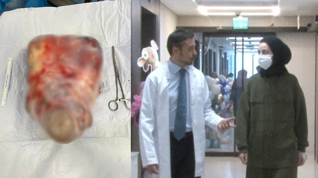 Fazla kilo sandı diyet yaptı: 5 kiloluk kisti vücudunda 1 yıl taşıdı