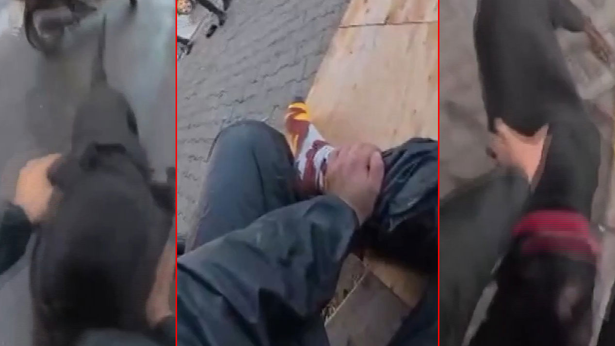 Ağızlıksız gezdirilen 'Rottweiler' dehşet saçtı: Önce bir kadına sonra kuryeye saldırdı