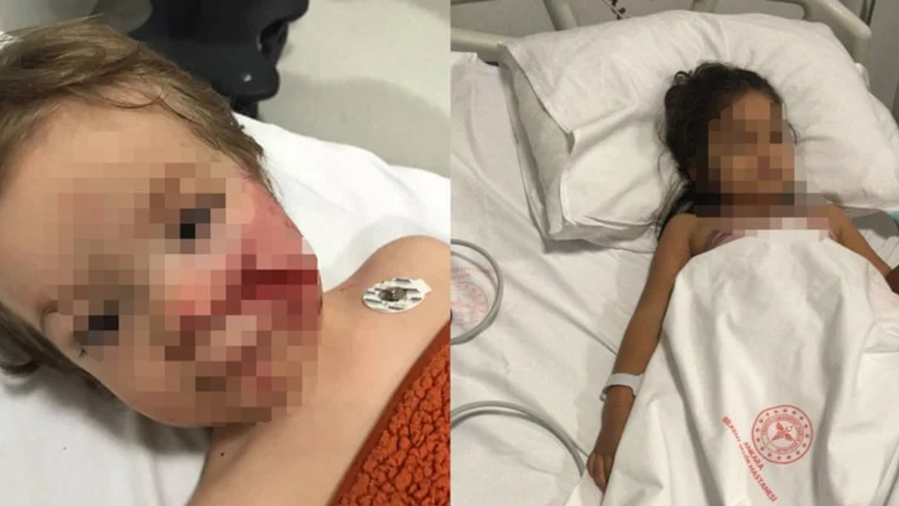 Ankara'da 2 çocuğun yaralandığı Pitbull faciasında flaş gelişme! Köpeğin sahibi tutuklandı