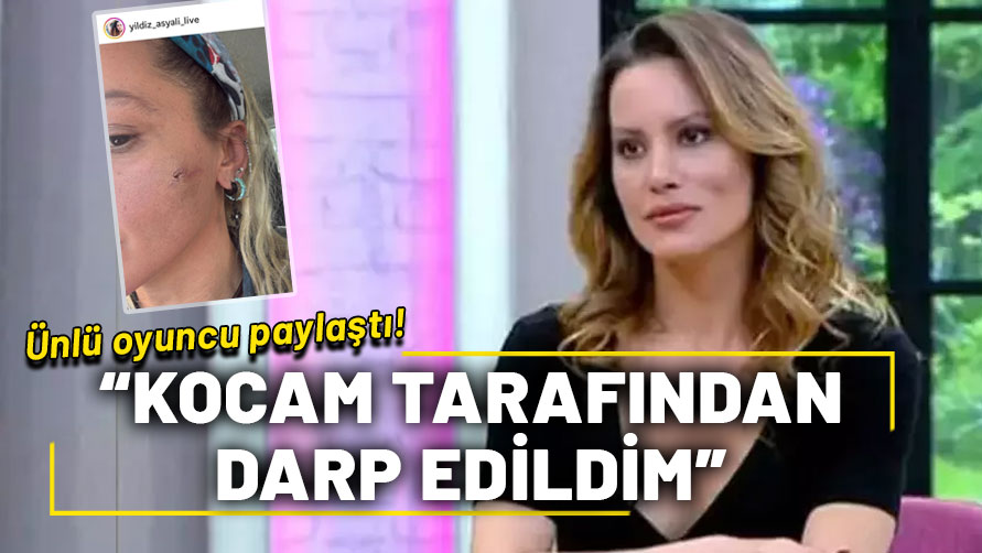 Ünlü oyuncu Yıldız Asyalı'nın sosyal medya paylaşımı gündem oldu! "Kocam tarafından darp edildim"