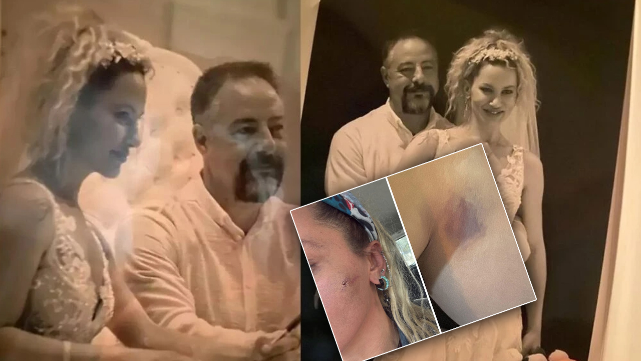 Oyuncu Yıldız Asyalı yaşadıklarını anlattı: 6-7 ay boyunca fiziksel ve psikolojik şiddet gördüm