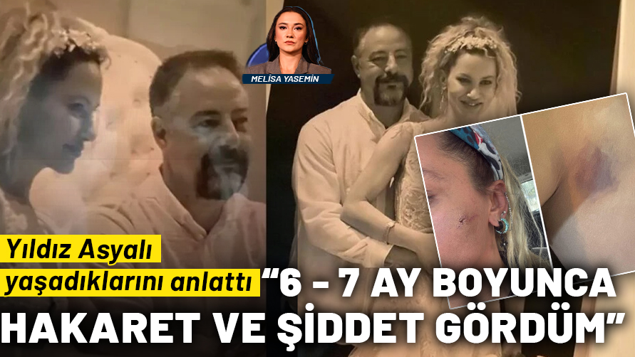 Oyuncu Yıldız Asyalı yaşadıklarını anlattı: 6-7 ay boyunca fiziksel ve psikolojik şiddet gördüm