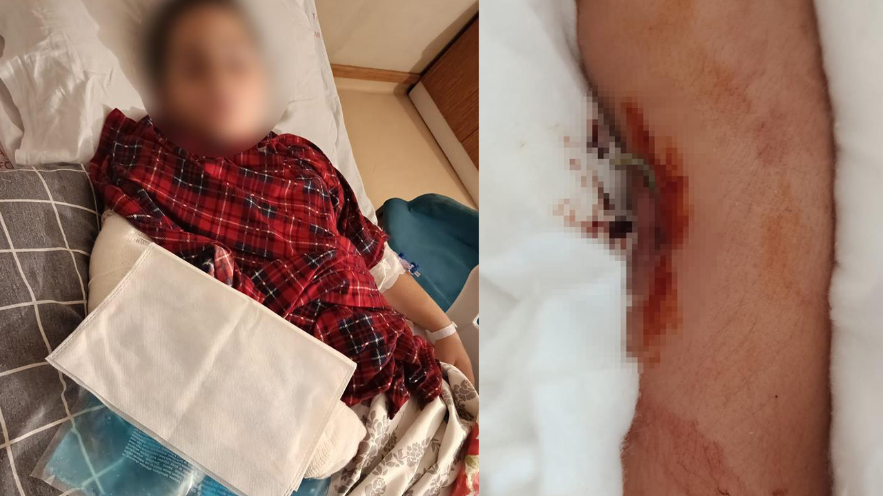 Akran zorbalığının yaşı düşüyor: 9 yaşındaki çocuk 8 yaşındaki arkadaşının kolunu 2 yerinden kırdı