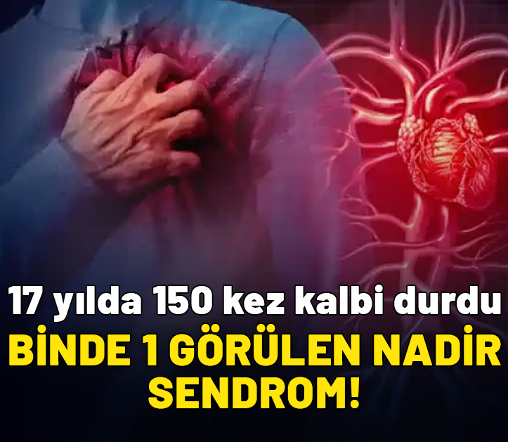 Binde 1 görülen nadir sendrom, 17 yılda 150 kez kalbini durdurdu