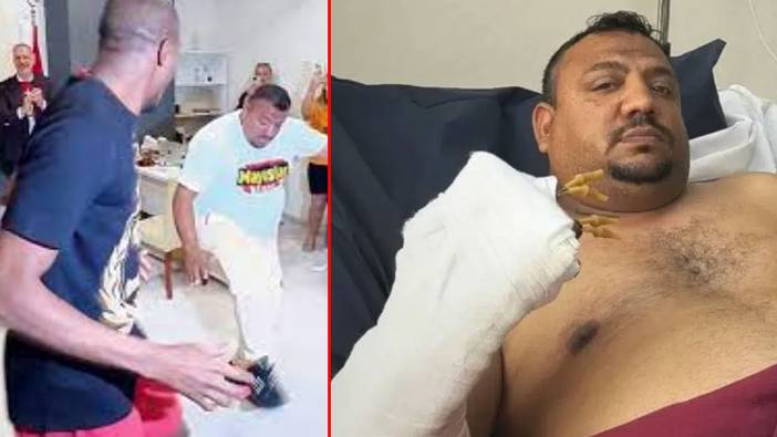 Osimhen ile göbek atmıştı, iş kazasında parmaklarını kaybetti: Nazar değdi, Osi bizi bırakma!