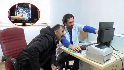 Gördükleri karşısında doktor şoka uğradı: Dünyada 47, Türkiye’de 2’nci kişi