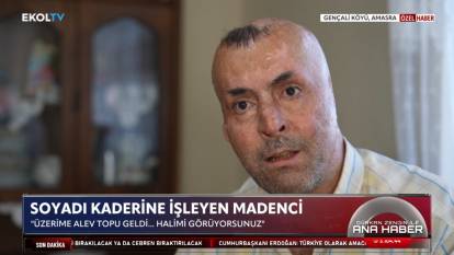 155 ameliyat oldu! Faciadan sağ kurtulan madencinin yaşam mücadelesi