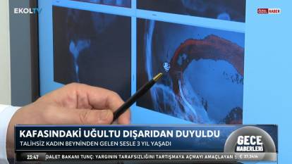 Böyle hastalık görülmedi: Kafasındaki motor sesi dışarıdan da duyuldu!