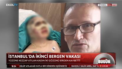 İkinci Bergen vakası! Kendisini reddeden kadının yüzüne kezzap atıp gözlerini kör etti