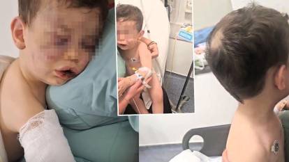 Kan donduran dehşet: 2 yaşındaki bebek annesinin sevgilisi tarafından öldüresiye dövüldü