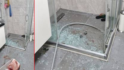 Duş kabininde korkunç olay! 80 yaşındaki akademisyen duş alırken cam patladı, kanlar içerisinde kaldı