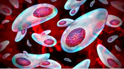 Sperm hücrelerini öldüren parazit: Çiğ etten bulaşıyor, kısırlıkta çarpıcı şüpheli!