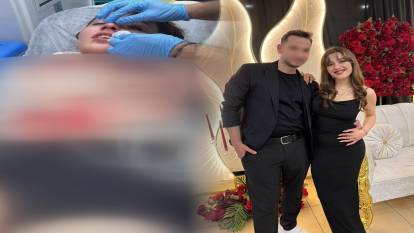 "Seni öldürürüm" dedi nişanlısını motorsiklet kaskıyla darbetti! Bahanesi pes dedirtti...