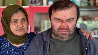 En yakını acımadı: Yüzde 90 engelli vatandaş darbedildi