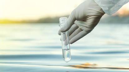 VİBRİO ENFEKSİYONU NEDİR? Vibrio enfeksiyonu nasıl bulaşır, vibrio enfeksiyonunun belirtileri nelerdir?