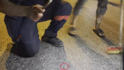 Hastanede fark ettiler! Kopan parmağı bulmak için seferber oldular