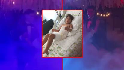 Düğünde sıvı azot kabusu! Küçük çocuk 7 operasyon geçirdi