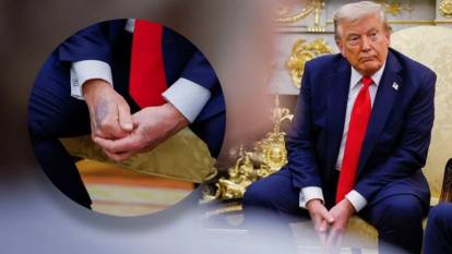 Trump'ın elindeki morluklar dikkat çekti: Beyaz Saray'dan açıklama geldi!