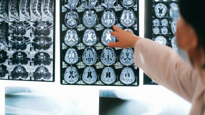 Beyni genç tutan alışkanlık ortaya çıktı! Alzheimer ve demans riskini yüzde 22 azaltıyor