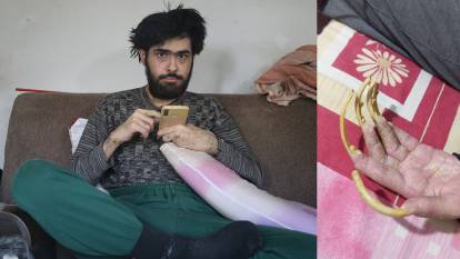 Depremin gölgesinde sanal dünyaya sığınan genç: 3 yıldır evden çıkmayan Barış, duş bile almıyor