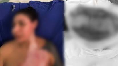 Kadıköy'de bir kadını alev alev yaktılar: Kıskançlık krizi dehşeti!